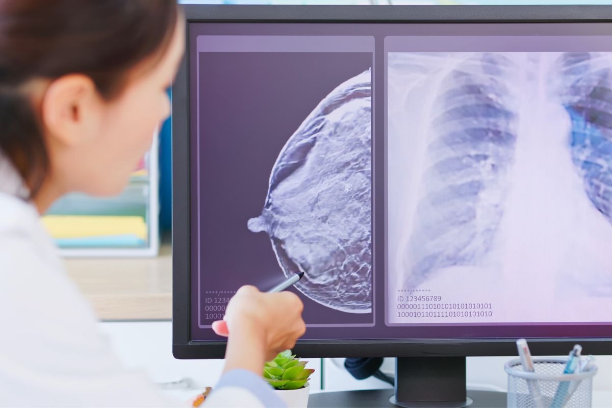 Dia Nacional da Mamografia em 5 de fevereiro