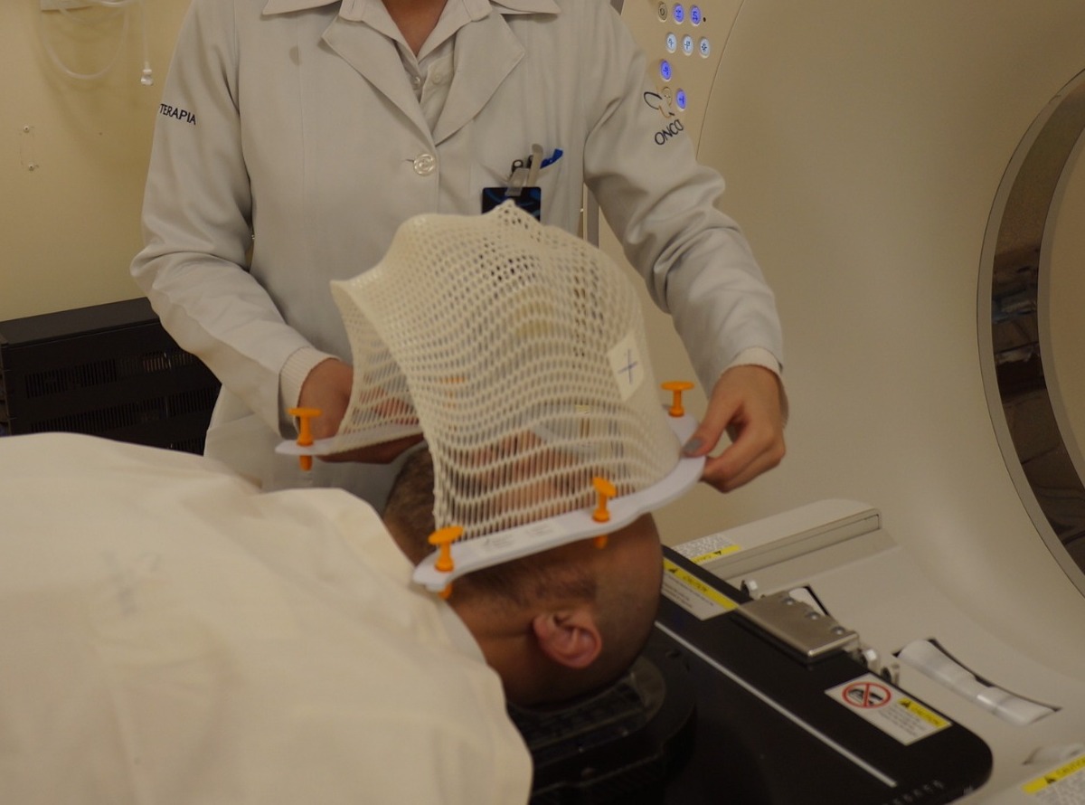 radioterapia-cabeca-pescoco